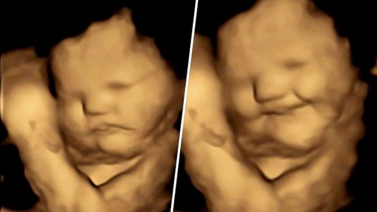 Yemek seçmeye erken başlıyoruz! Henüz anne karnında tat ve koku alabildiğimiz ortaya çıktı