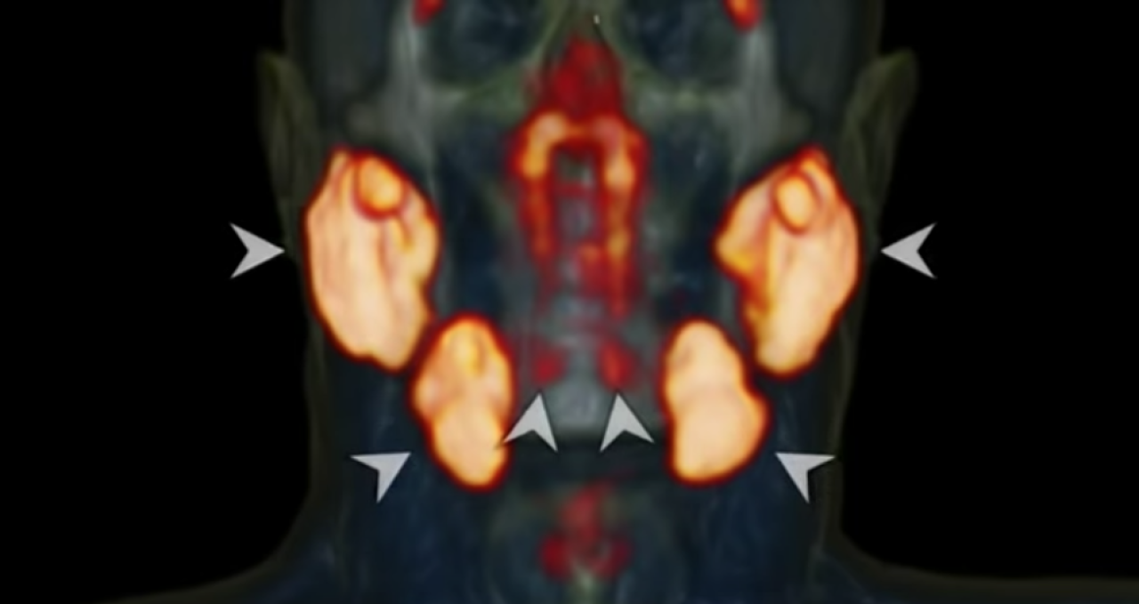 İnsan yüzünün içinde gizlemiş yepyeni bir organ bulundu
