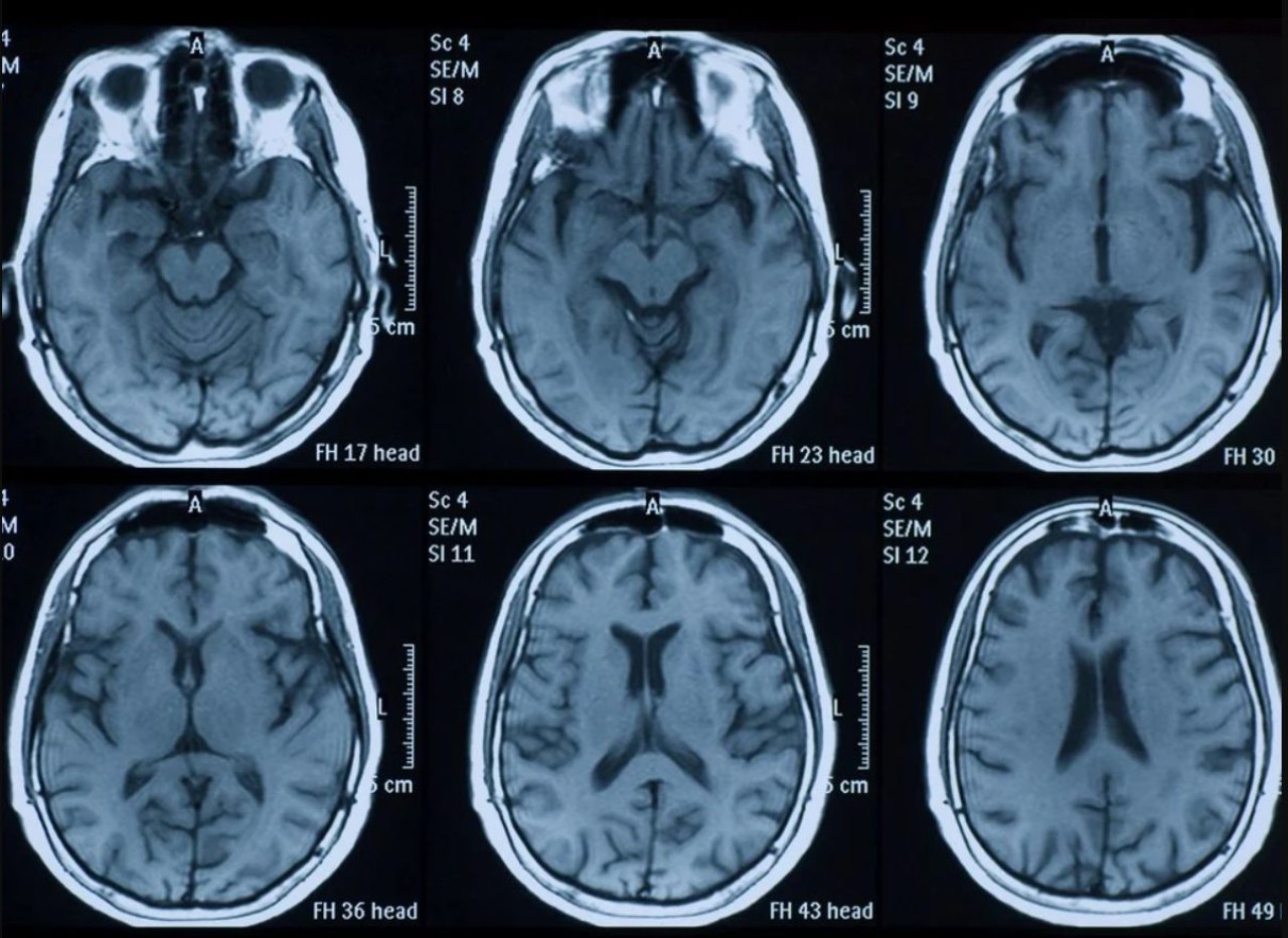 Beynimizin yüzde kaçını kullanıyoruz?