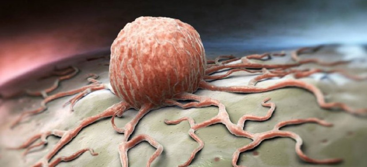 Yeni bir kanser aşısı geliştirildi! Başarı oranı %93