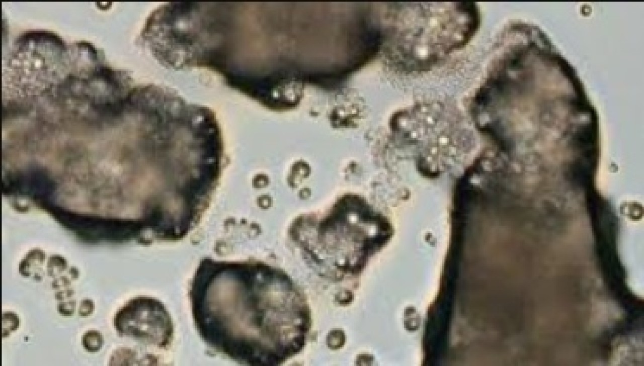 90 türü yok eden katil mantara karşı umut