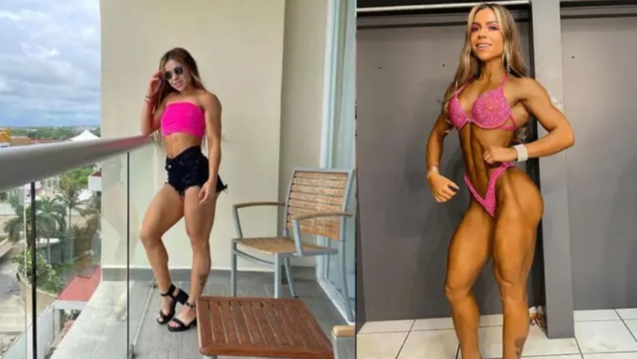 Terlemeyi azaltma ameliyatı,  güzel fenomenin hayatına mal oldu