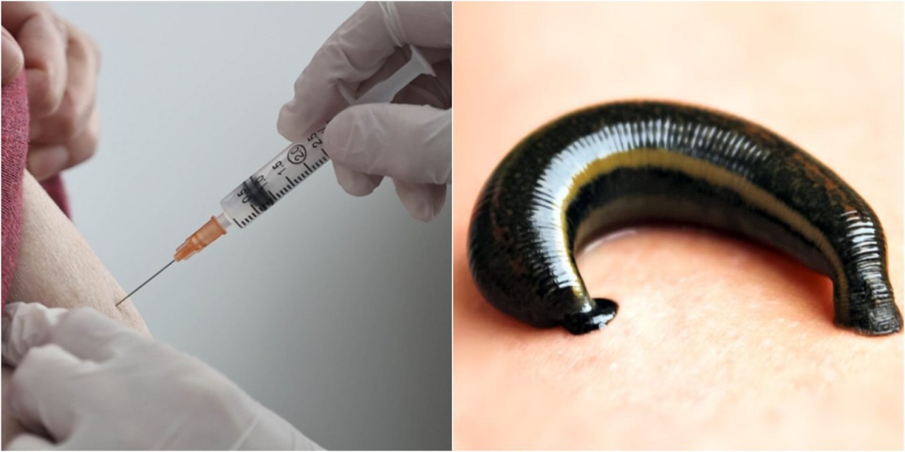 PCR testinden kaçmak isteyen aşı karşıtı,  aşıdan sonra koluna sülük yapıştırdı! Bu kadarına da pes...