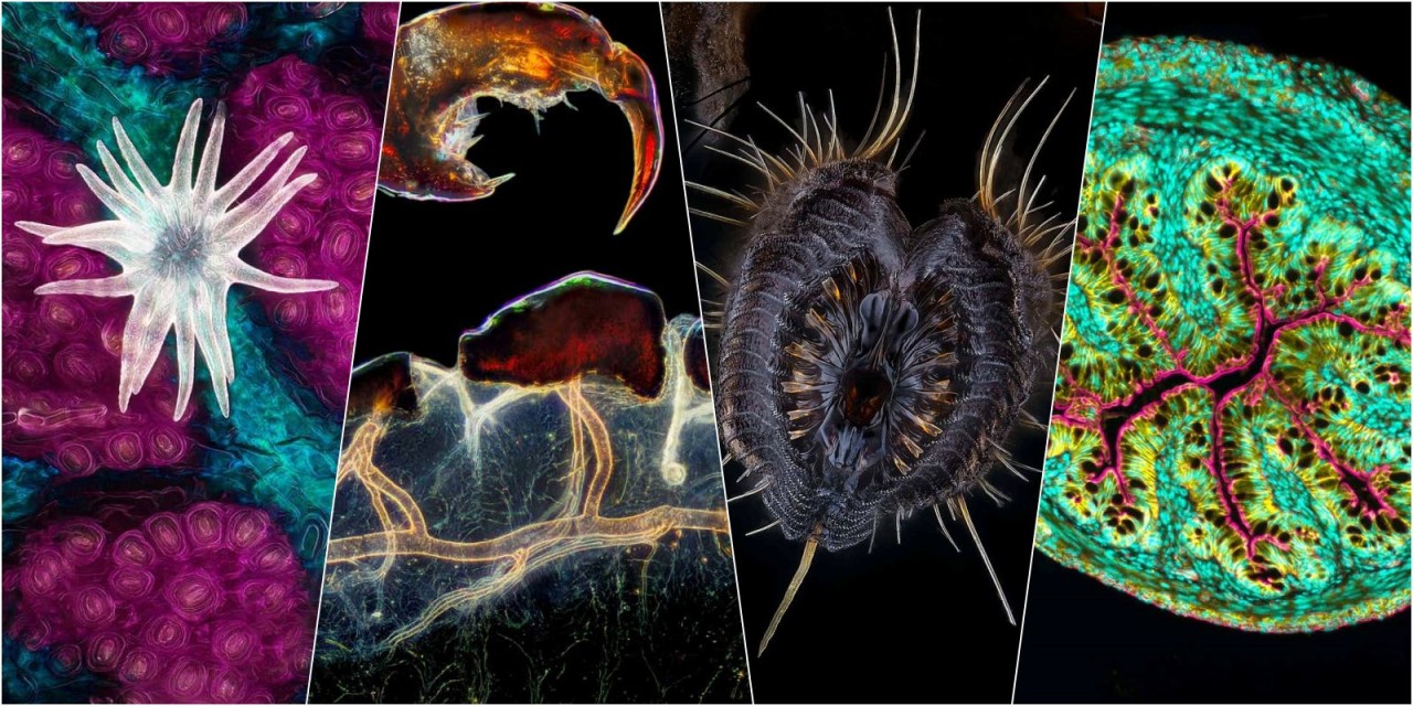 2021'in en iyi mikroskobik fotoğrafları! Hayranlık uyandıran renkler...