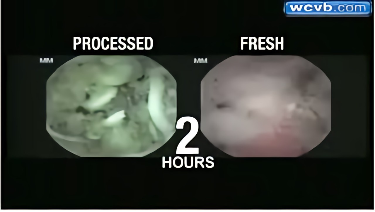 Hazır noodle yemek vücudumuza ne gibi zararlar verebilir?- VİDEO