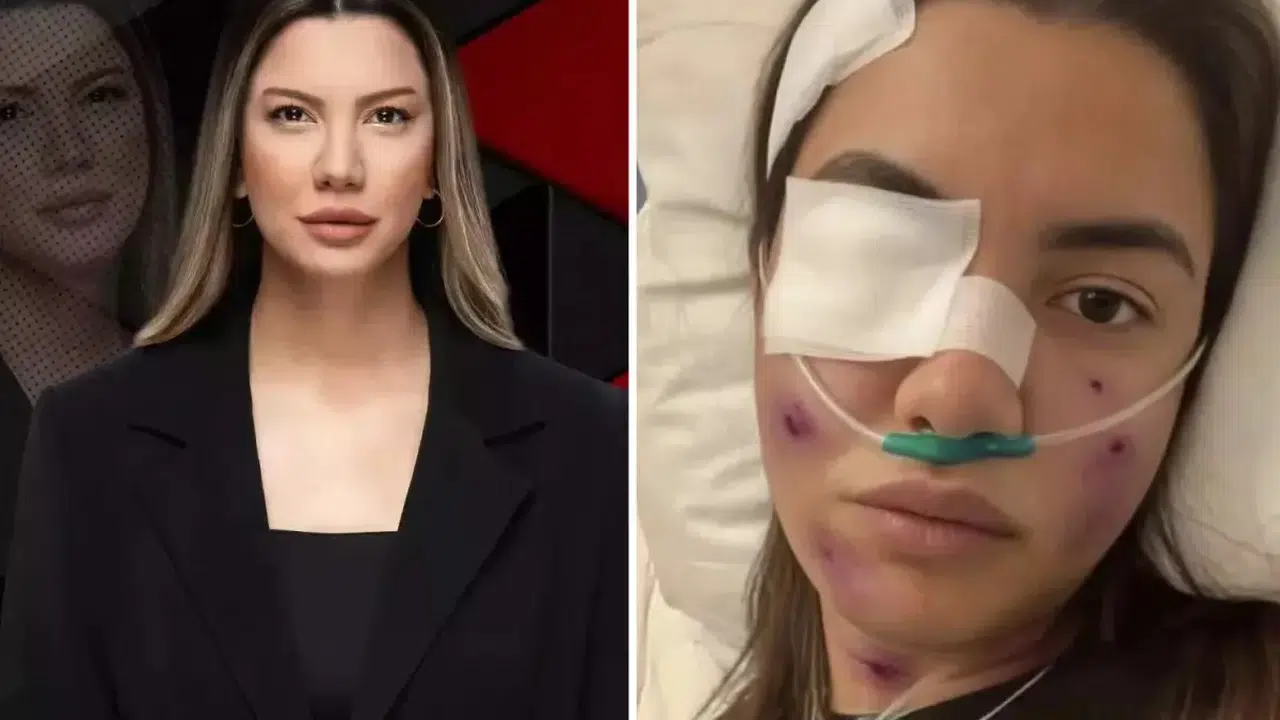 Fulya Öztürk Trafik Kazası Geçirdi Mi? Sosyal Medyada Yaygınlaşan Sahte Görsel Hakkında Açıklama Geldi