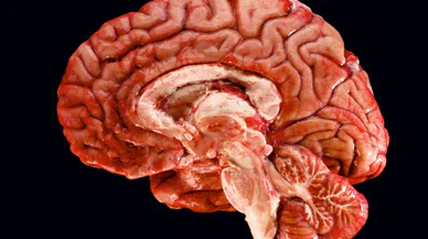 İnsan beynini farklı kılan şey nedir?