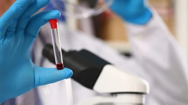 Tarihin en pahalı ilacı Hemgenix: Tek dozu 3.5 milyon dolar