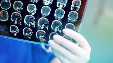 Nöbet geçiren adam,  kendine geldiğinde Fransızca konuşmaya başladı!