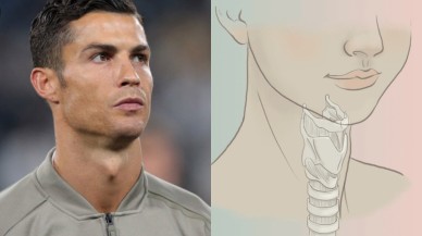 Adem elması nedir? Sadece erkeklerde mi bulunur? Ne işe yarar? İsmi nereden geliyor?