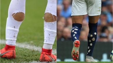 Dünya Kupası'nda da sıkça gördük: Futbolcular çoraplarını neden keser? Çoraplarındaki delikler ne işe yarıyor?