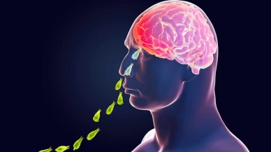 Musluk suyuyla burnunu yıkadıktan sonra beynini yiyen bir enfeksiyon nedeniyle öldü!