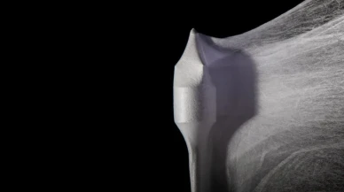 Hardvard,  kalp kapakçığı için sentetik bir çözüm geliştirdi!