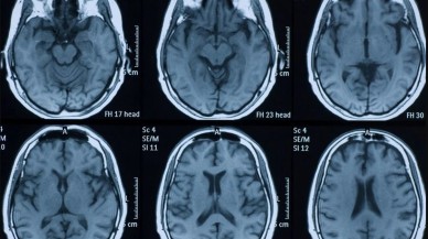 Beynimizin yüzde kaçını kullanıyoruz?