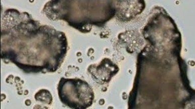 90 türü yok eden katil mantara karşı umut