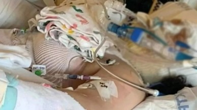 TikTok'un trend olan bir akımına katılan 13 yaşındaki kız,  canından oluyordu