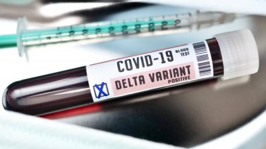 Prof. Dr. Yalçın: Delta varyantı yüzde 60 daha bulaşıcı ve etkin