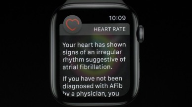 Doktor Watch diyeceksiniz! Apple Watch,  bir hayat daha kurtardı