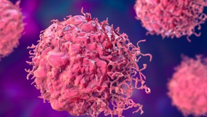 Kemoterapiye bile yanıt vermeyen yeni bir kanser türü ortaya çıktı