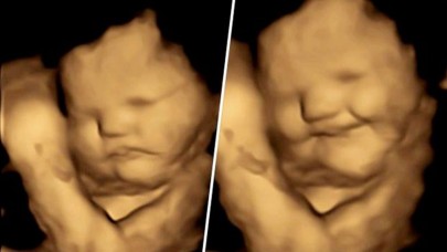 Yemek seçmeye erken başlıyoruz! Henüz anne karnında tat ve koku alabildiğimiz ortaya çıktı