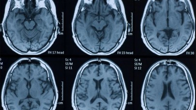 Beynimizin yüzde kaçını kullanıyoruz?