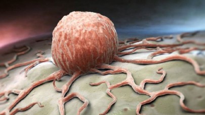 Yeni bir kanser aşısı geliştirildi! Başarı oranı %93