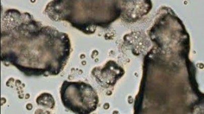 90 türü yok eden katil mantara karşı umut