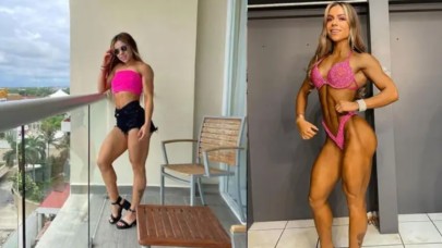 Terlemeyi azaltma ameliyatı,  güzel fenomenin hayatına mal oldu