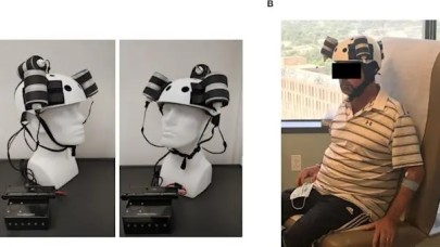 Beyin tümörü için manyetik alan tedavisi uygulayan kask geliştirildi