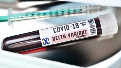 Prof. Dr. Yalçın: Delta varyantı yüzde 60 daha bulaşıcı ve etkin