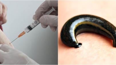 PCR testinden kaçmak isteyen aşı karşıtı,  aşıdan sonra koluna sülük yapıştırdı! Bu kadarına da pes...