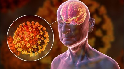 Koronavirüs beyni küçültüyor! Uzmanlar endişeli...