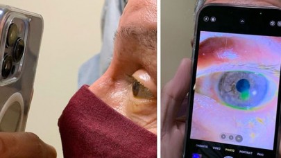 iPhone 13 Pro Max ile göz muayenesi yaptı!