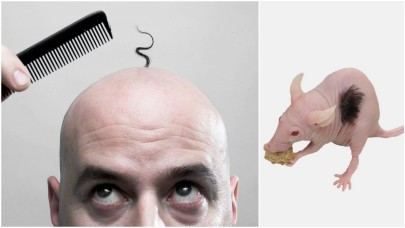 Kelliğe çare mi olacak? Fareler üzerinde insan saçı hücresi yetiştiriliyor