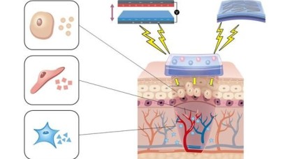 Elektrik üreten bandajlar ile yaralar daha hızlı iyileşecek!