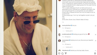 Afazi hastalığına yakalanan Bruce Willis oyunculuğu bıraktı! Afazi hastalığı nedir?