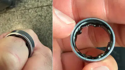 Bataryası Şişen Akıllı Yüzük Kullanıcıyı Hastanelik Etti! Samsung'dan Açıklama Geldi