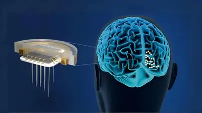 Beyin Çiplerinde Ameliyat Dönemi Sona Eriyor: MIT'den İğneyle Enjekte Edilen Teknoloji