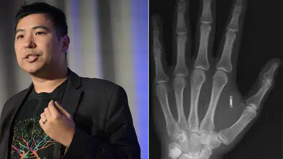 Eline Taktığı Çipin Parolasını Unuttu: Genç Adamın Tuhaf Deneyimi