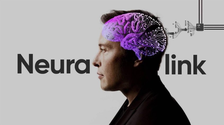 Neuralink,  ikinci beyin implantı hastası hakkında bilgi verdi!