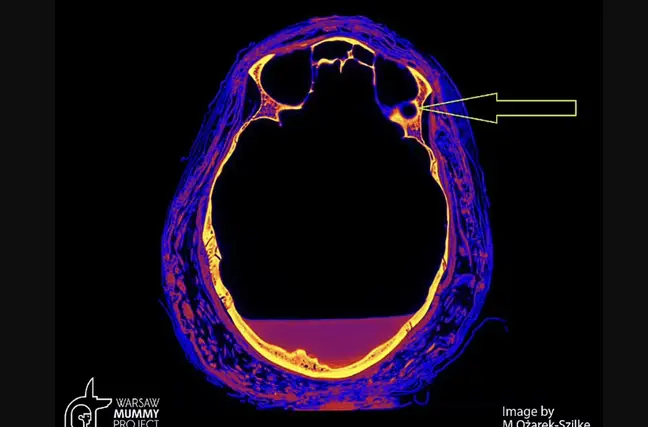 gizemli kadın mumyası (3)