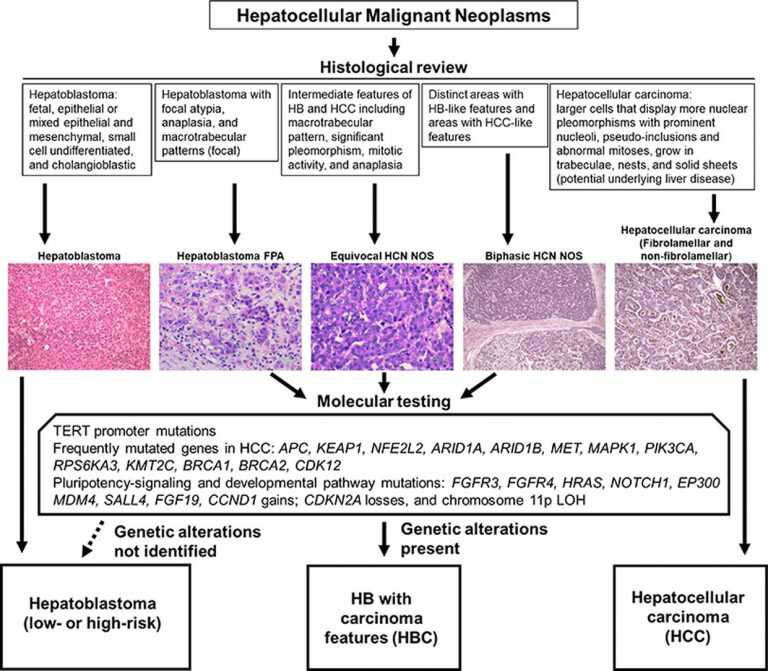 Hepatocellular-Malignant-Neoplasms-Testing-Graphic