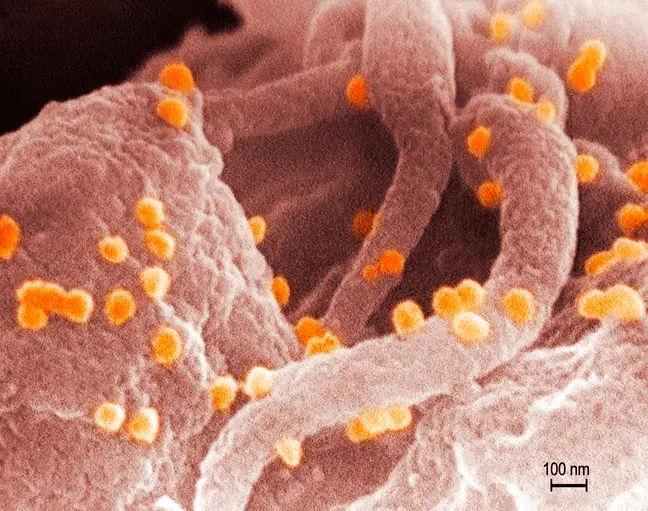 hıv hastası iyileşti (2)