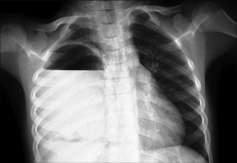 Kemik kaybının önüne geçecek yeni bir protein bulundu 3