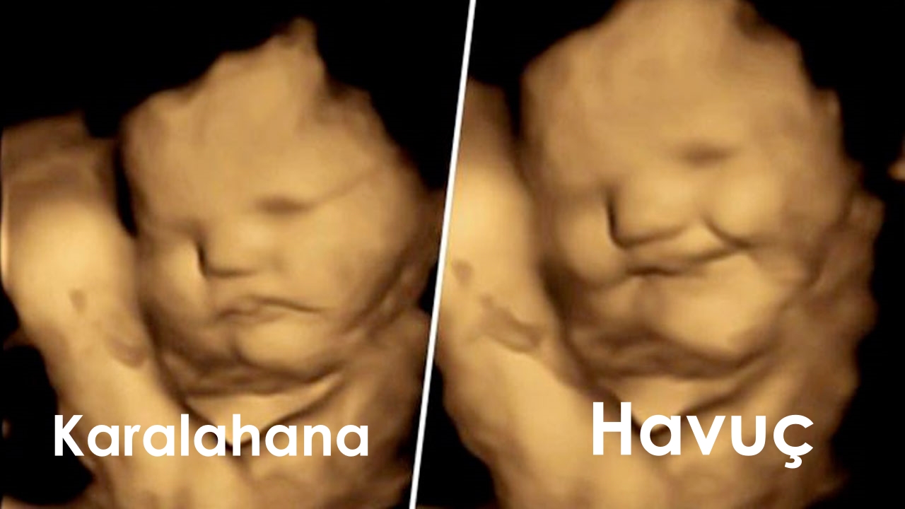 dcfae14c9060eb9a8d73646a20fb56a49a40adab