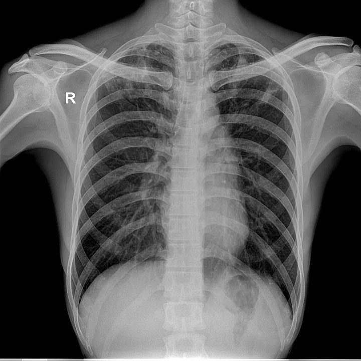 Kemik kaybının önüne geçecek yeni bir protein bulundu 2